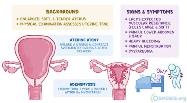 What is a distended uterus?